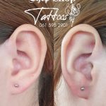 Lobes